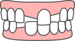 tooth4